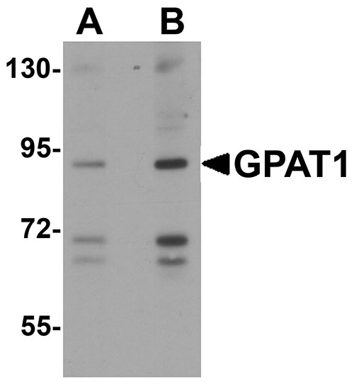 1 - GPAT1 Antibody ASC10696