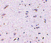 2 - Syntaphilin Antibody ASC10698