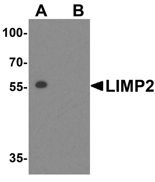 1 - LIMP2 Antibody ASC10700