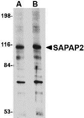 1 - SAPAP2 Antibody ASC10702