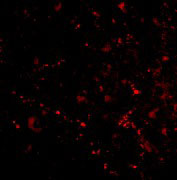 3 - SATB2 Antibody ASC10704