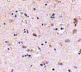 2 - SATB2 Antibody ASC10704