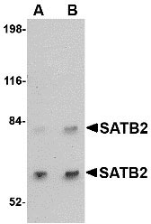 1 - SATB2 Antibody ASC10704