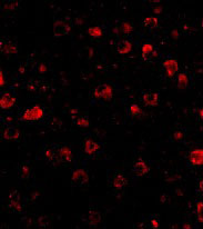 3 - SATB1 Antibody ASC10705