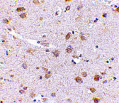 2 - SATB1 Antibody ASC10705
