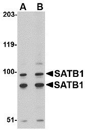 1 - SATB1 Antibody ASC10705