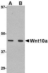 1 - Wnt10a Antibody ASC10708