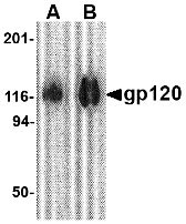 1 - gp120 Antibody ASC10709