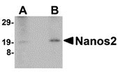 1 - Nanos2 Antibody ASC10710