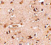 2 - Nanos2 Antibody ASC10711