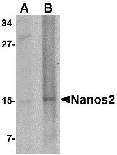 1 - Nanos2 Antibody ASC10711