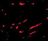 3 - Slc22A17 Antibody ASC10713