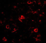 3 - Nanos3 Antibody ASC10714