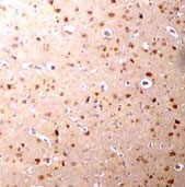 2 - Nanos3 Antibody ASC10714