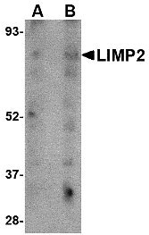 1 - LIMP2 Antibody ASC10715