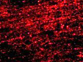 3 - CLIP170 Antibody ASC10717