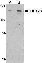 1 - CLIP170 Antibody ASC10717