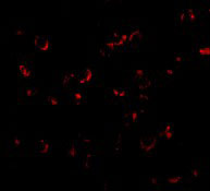 3 - BICD1 Antibody ASC10719
