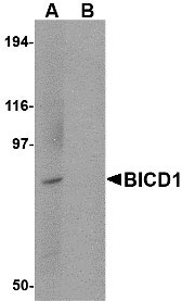 1 - BICD1 Antibody ASC10719