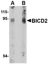 1 - BICD2 Antibody ASC10720
