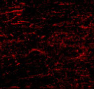 3 - SATB1 Antibody ASC10722