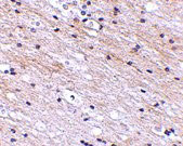 2 - SATB1 Antibody ASC10722