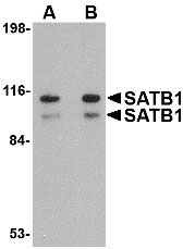 1 - SATB1 Antibody ASC10722