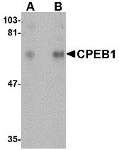 1 - CPEB1 Antibody ASC10725