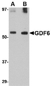 1 - GDF6 Antibody ASC10726