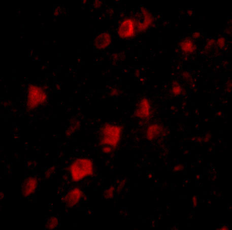 3 - POLR3F Antibody ASC10735