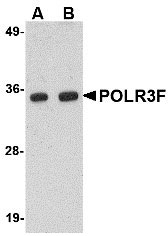 1 - POLR3F Antibody ASC10735