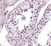 2 - MED4 Antibody ASC10736