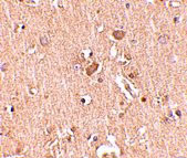 2 - MED28 Antibody ASC10737