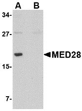 1 - MED28 Antibody ASC10737