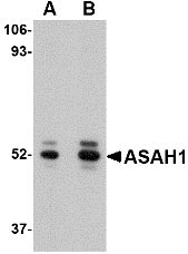 1 - ASAH1 Antibody ASC10740