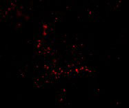 3 - TRIM30 Antibody ASC10742