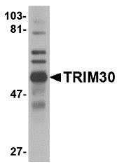 1 - TRIM30 Antibody ASC10742