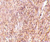 2 - TRIM30 Antibody ASC10743