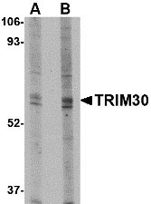 1 - TRIM30 Antibody ASC10743