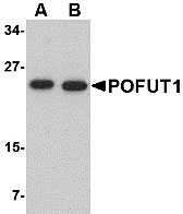 1 - POFUT1 Antibody ASC10751