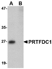 1 - PRTFDC1 Antibody ASC10754
