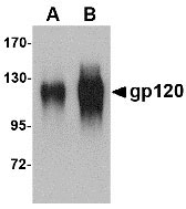 1 - gp120 Antibody ASC10755