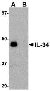 1 - IL-34 Antibody ASC10756