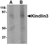 1 - KINDLIN3 Antibody ASC10764