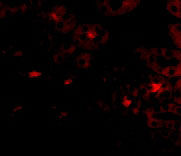 3 - OTUD5 Antibody ASC10771