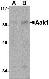 1 - Aak1 Antibody ASC10777