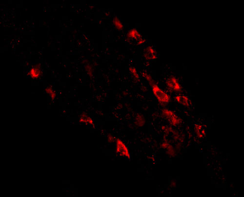 3 - Rkhd1 Antibody ASC10779