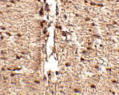 2 - Rkhd1 Antibody ASC10779