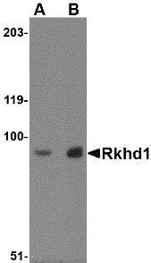 1 - Rkhd1 Antibody ASC10779