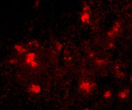 3 - Dact2 Antibody ASC10789